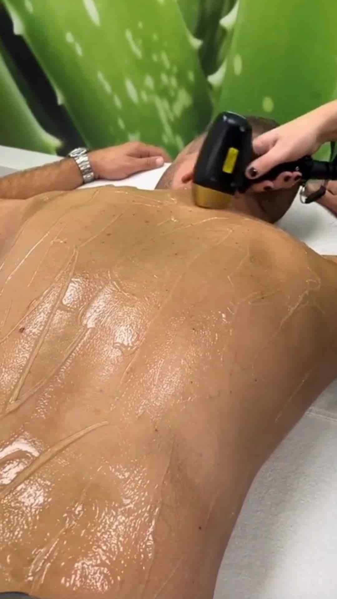 laser ontharing heren Waalwijk