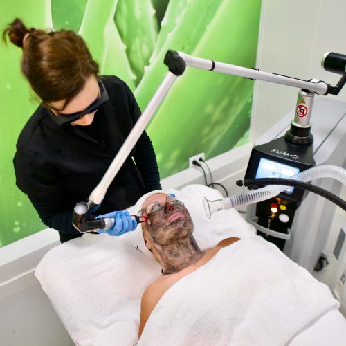 Alma-Q behandeling in onze salon in Waalwijk.