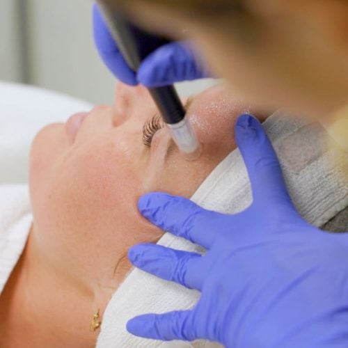 Microneedling dermapen Waalwijk